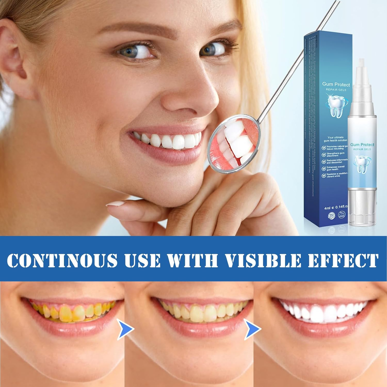 Frosty Neptune Essence Teeth Whitening Kit (3 Pieces)